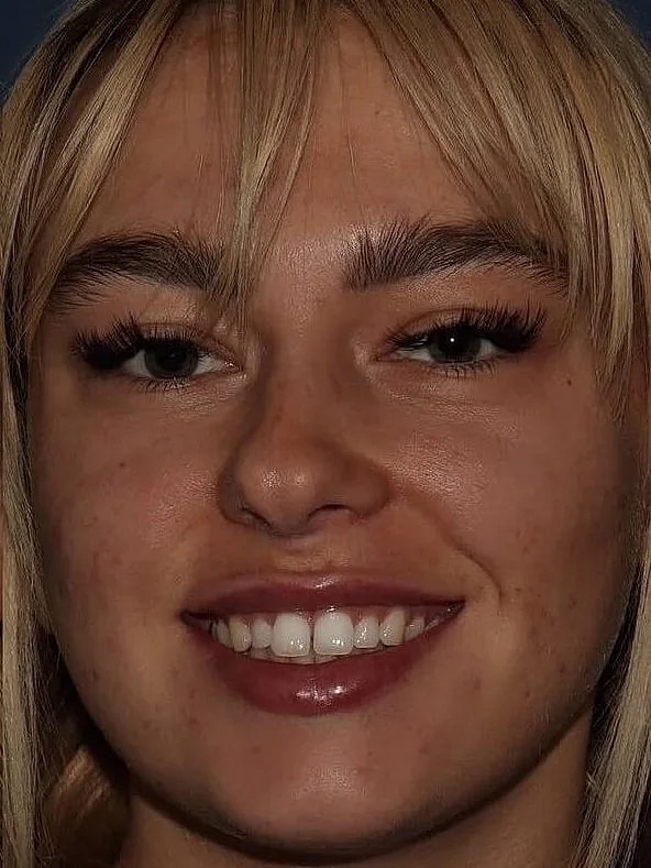 Smiling person with blonde hair and eyelashes.