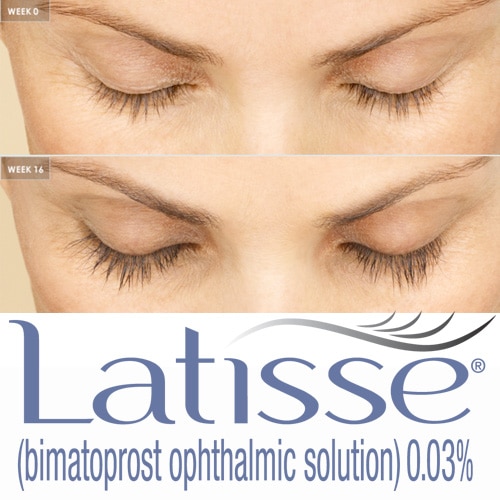 Latisse Before and After treatment result